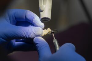 Read more about the article Which is better: dental floss or irrigator?