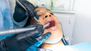 Read more about the article When are teeth treated under general anesthesia?